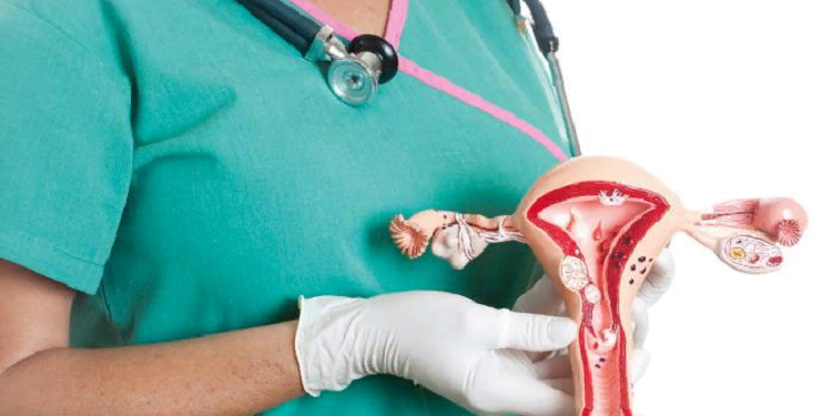 Доброкачественное образование (миома) матки и ее симптомы