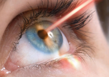 Способы лазерной коррекции зрения и советы