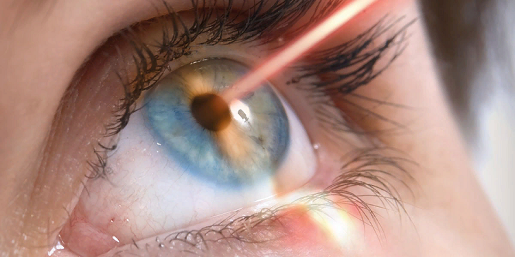 Способы лазерной коррекции зрения и советы