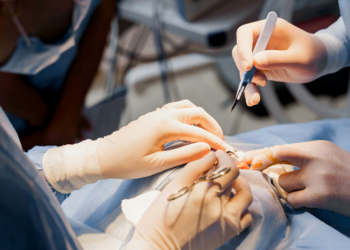 Правила и этапы проведения операций на хрусталике глаза