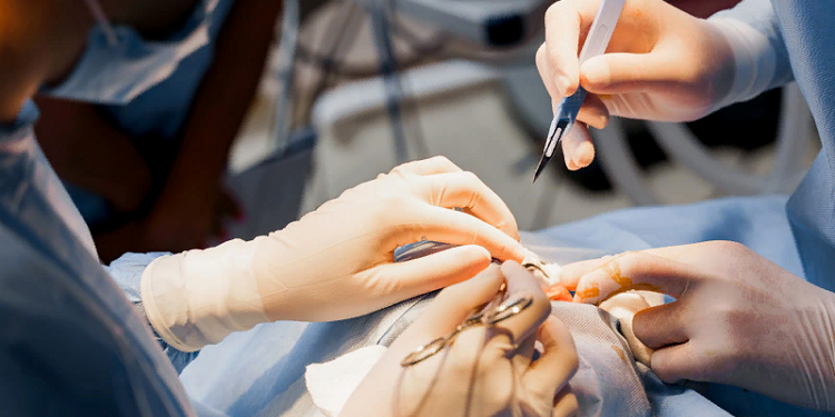 Правила и этапы проведения операций на хрусталике глаза