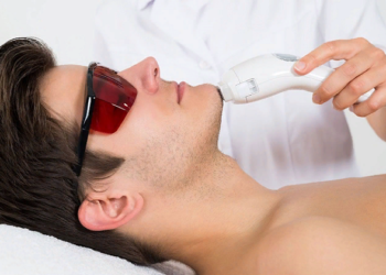 Правила лазерной эпиляции бороды мужчинам