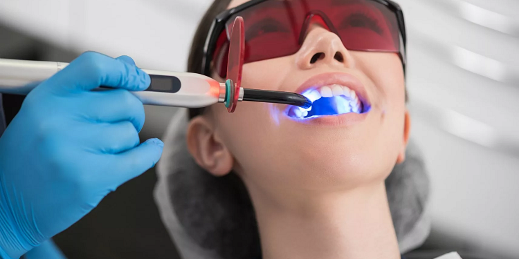Отбеливание зубов: особенности, технология и правила выполнения