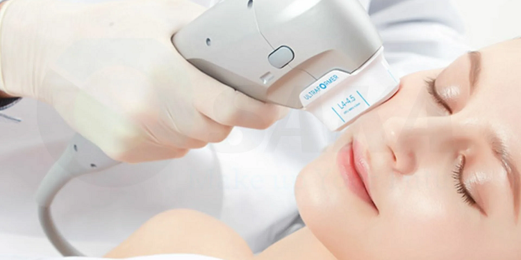 Ультразвуковой SMAS-лифтинг с UltraFormer: достоинства и описание