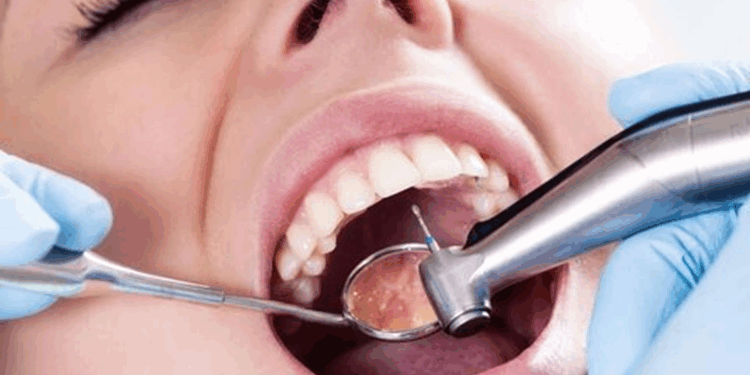 Лечение кариеса: современные техники, правила и советы