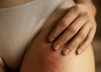 Лазерная эпиляция бикини: противопоказания, ощущения и результаты