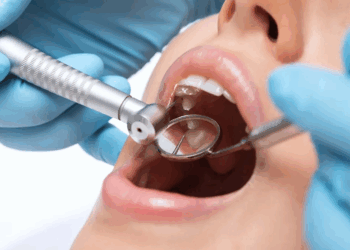 Лечение кариеса у взрослых: правила и особенности